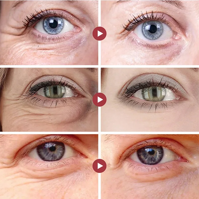 Rugas remover os olhos remendo - Eye Pad Collagen avaliação e preço
